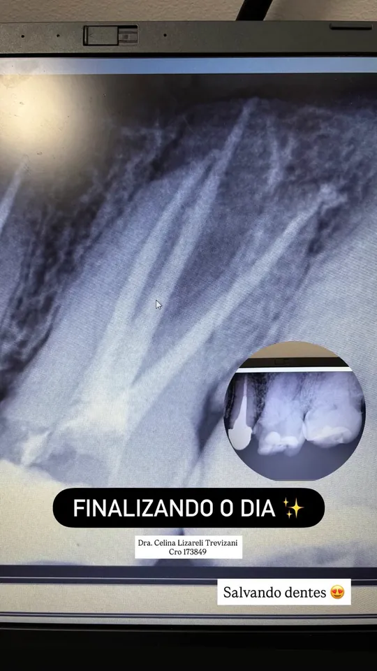 Radiografia ao final de um atendimento.